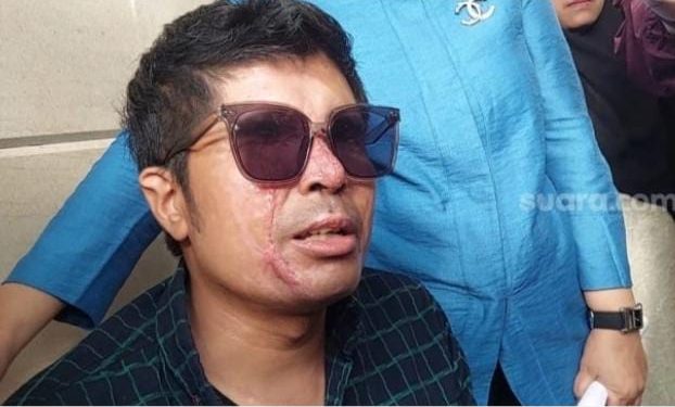 Agus Salim Gagal Dapat Donasi 1,3 M.