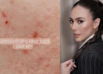 Wulan Guritno Tanggapi Komentar Julid Netizen yang Sebut Wajahnya Gradakan: “Yang Penting Aku Bahagia”