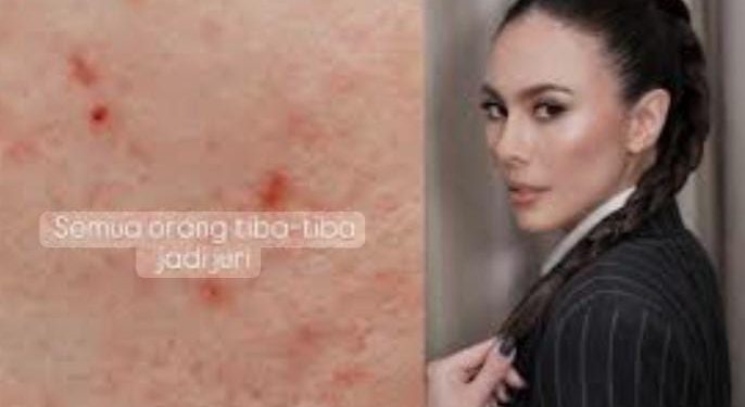 Wulan Guritno Tanggapi Komentar Julid Netizen yang Sebut Wajahnya Gradakan: “Yang Penting Aku Bahagia”