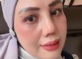 Elly Sugigi Pamer Wajah Baru Usai Rhinoplasty, Sebut Bukan Demi Ikut Tren