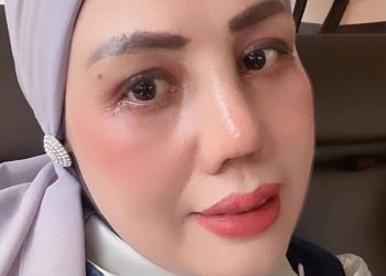 Elly Sugigi Pamer Wajah Baru Usai Rhinoplasty, Sebut Bukan Demi Ikut Tren