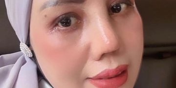 Elly Sugigi Pamer Wajah Baru Usai Rhinoplasty, Sebut Bukan Demi Ikut Tren